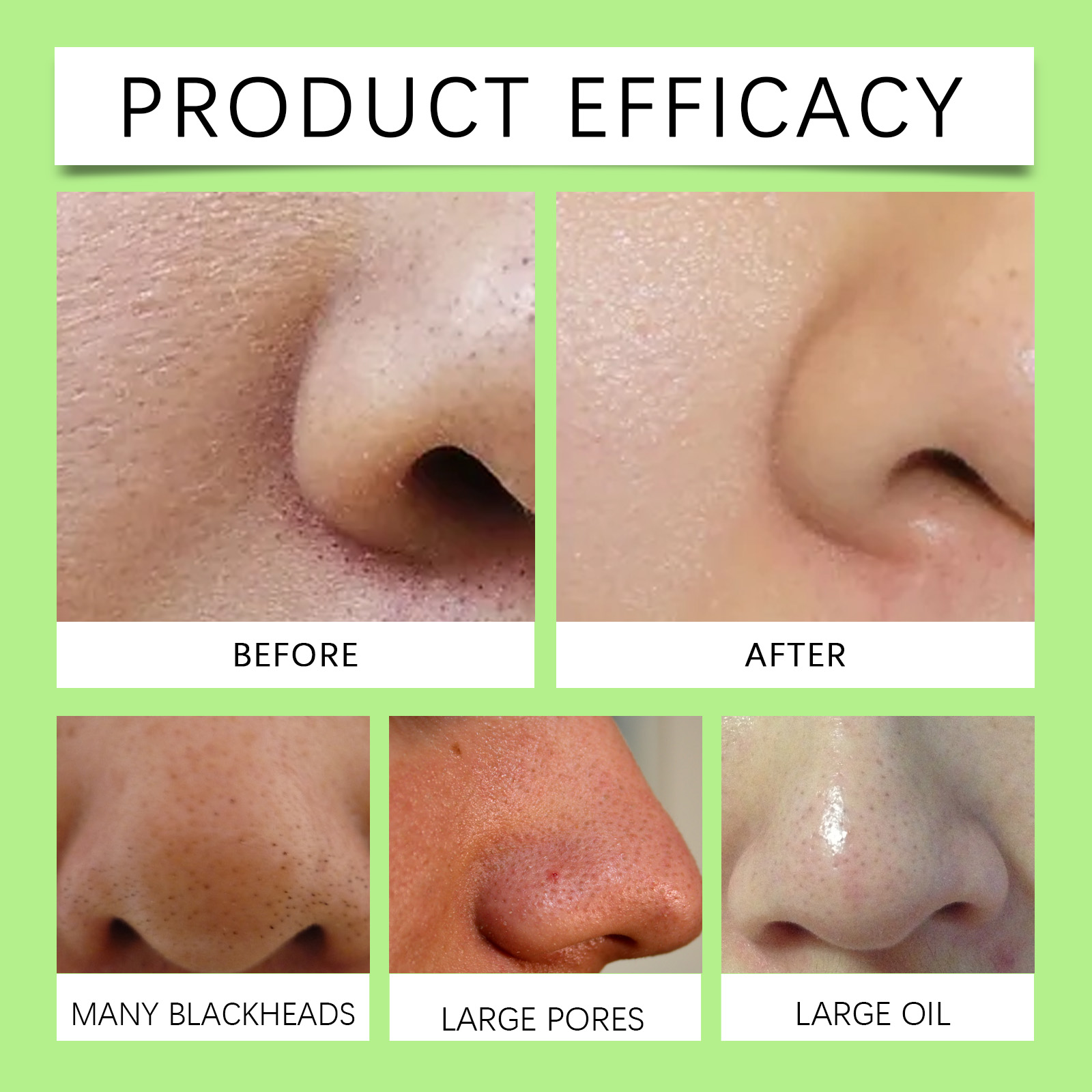 Bandes nasales au charbon de b - Cleanser Face avis et prix